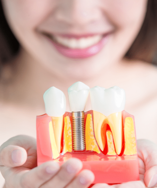 Best Dental Implants in Worth, IL. Book your implant consultation now