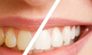 Latest Developments in Dental Care